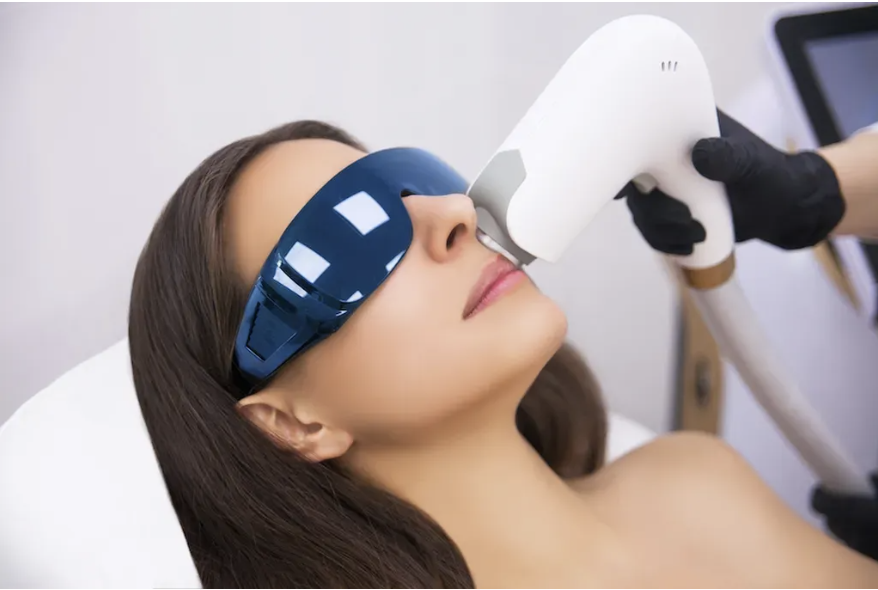 IPL Laser Rejuvenation