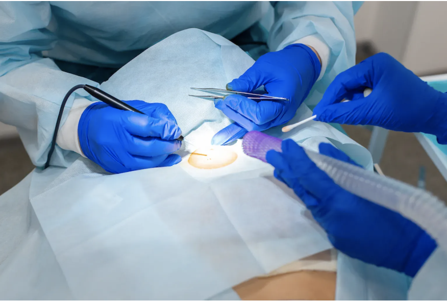 Skin Cancer Surgery
